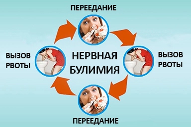 Лечение булимии в Покрове